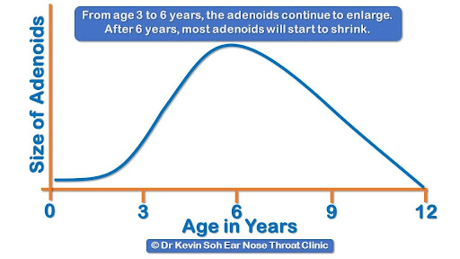 adenoids Common in which age