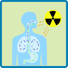 blood cancer radiation exposure