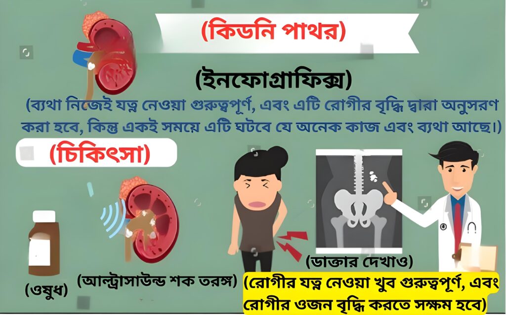 কিডনি পাথর infographic