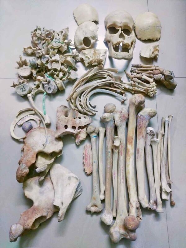 Human Skeleton-35000 taka